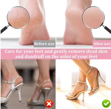 Electric Foot File and Callus Remover with 60 Sandpapers - Daily New Trends Megastore